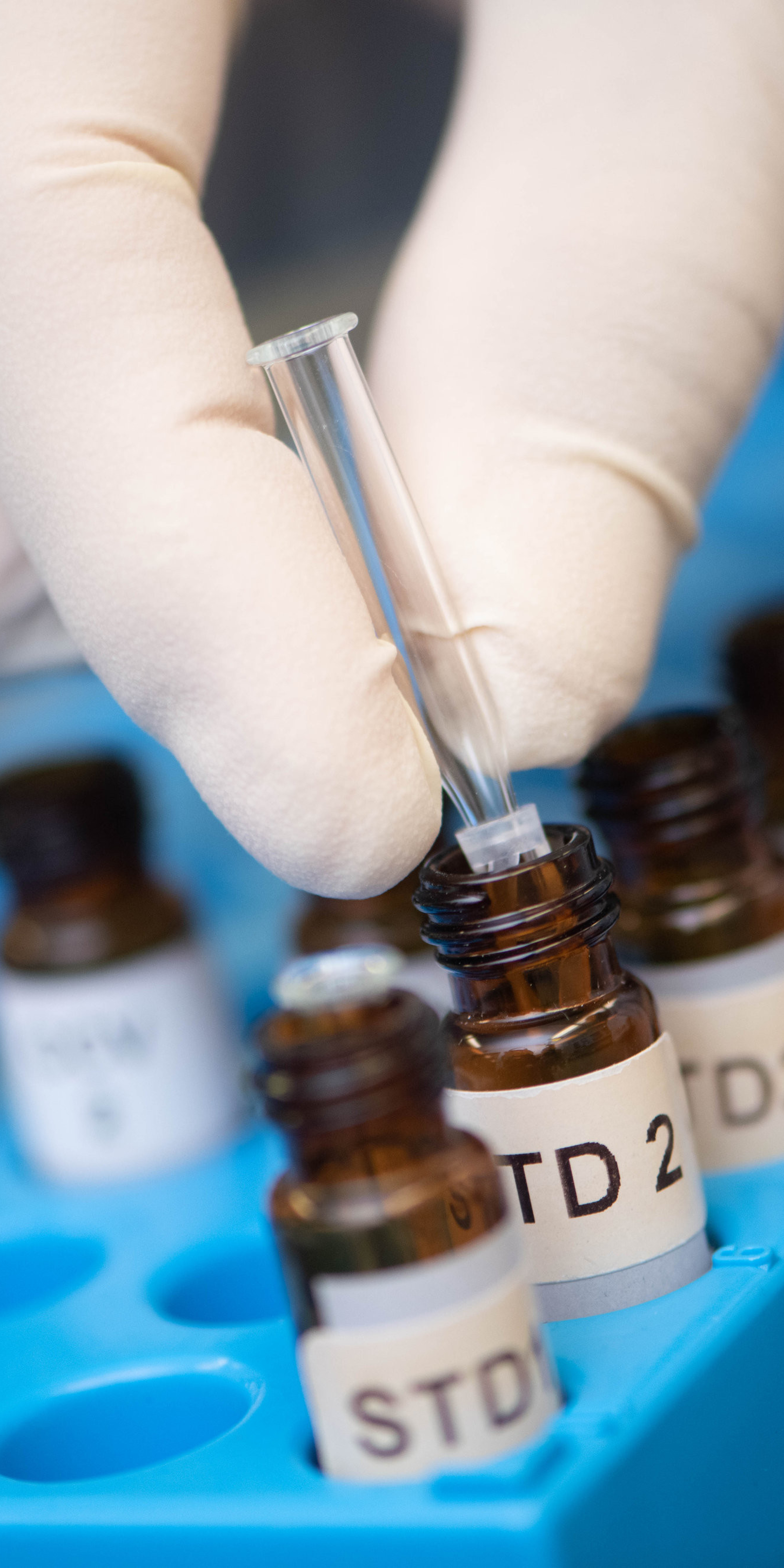 person putting a sample inside a test bottle